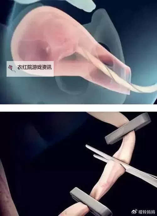 生动记录:孕妇生产过程视频全景揭示临产时刻图1