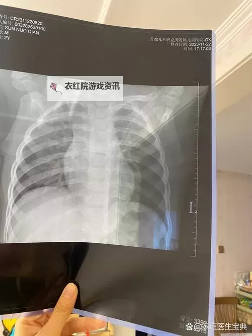 2023年最新热点:胸片曝光没有衣服事件引发关注图1