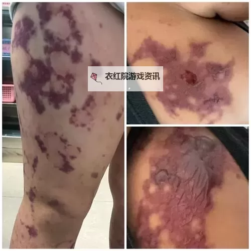 紫黑色肿大横冲直撞：暗影中的恐怖谜团图1