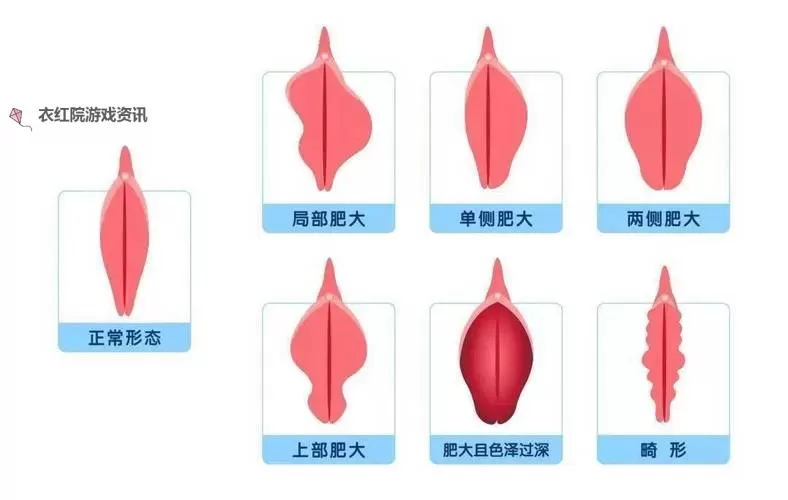 正常阴脣的样子照片视频：解剖之美与医学科普的影像之旅图1